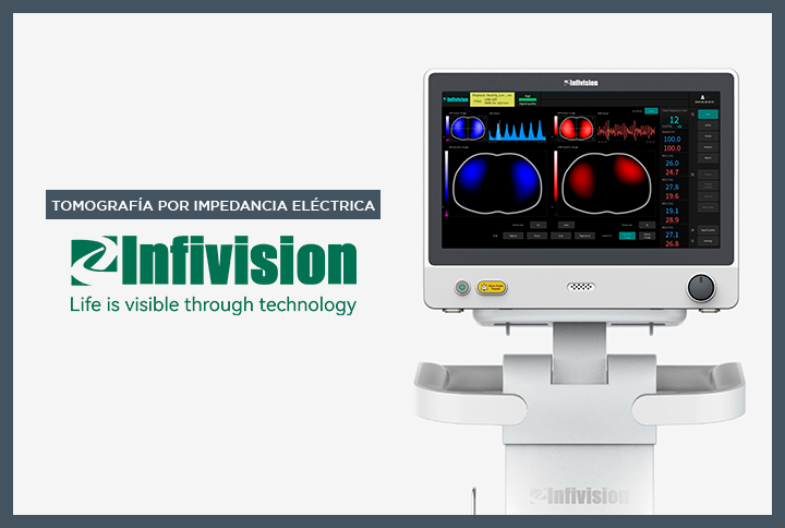 Tomografía por impedancia eléctrica - Infivision