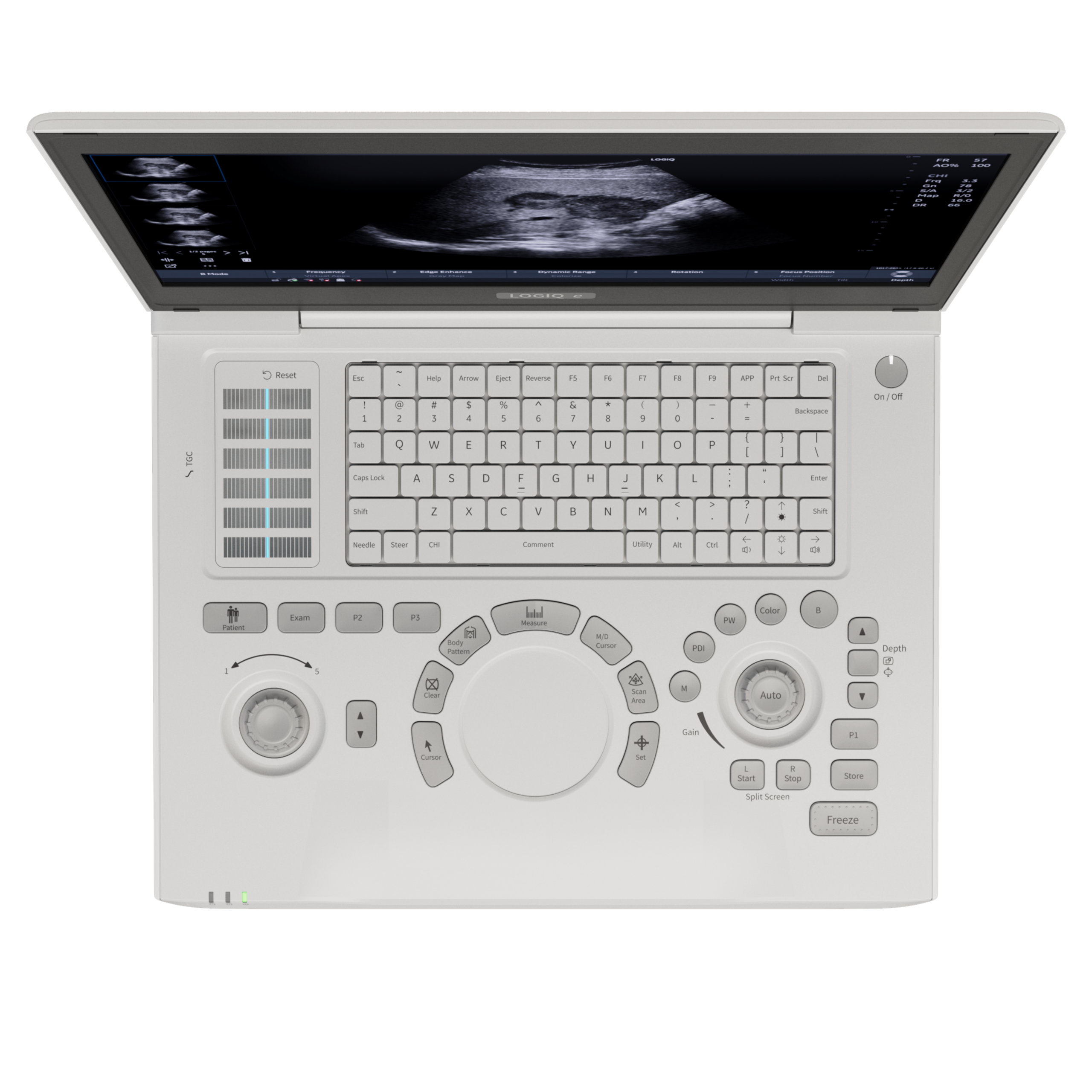 LOGIQ e – top view – TRACKPAD LOGIQ e – top view – TRACKPAD