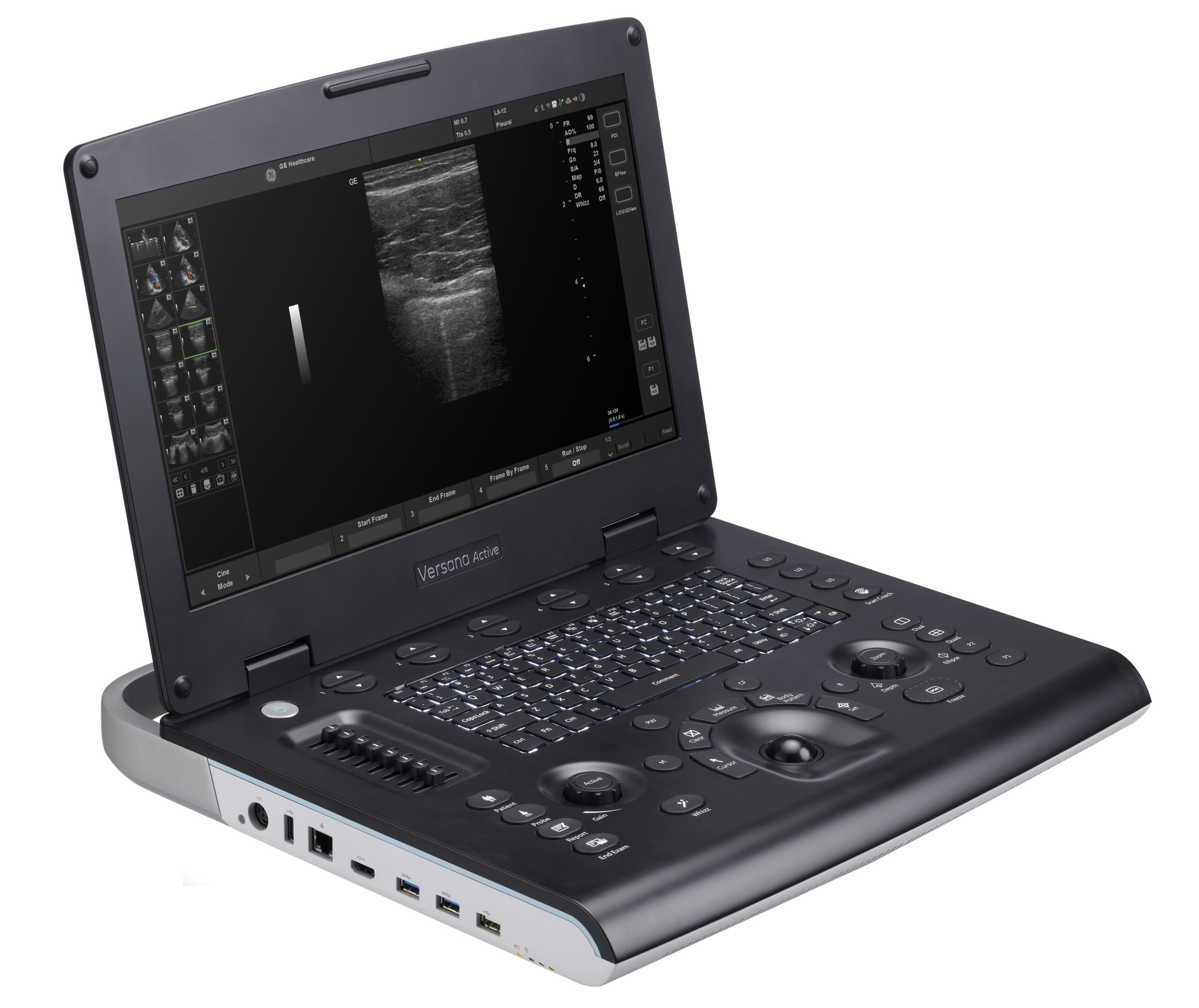 GE HealthCare Versana Active